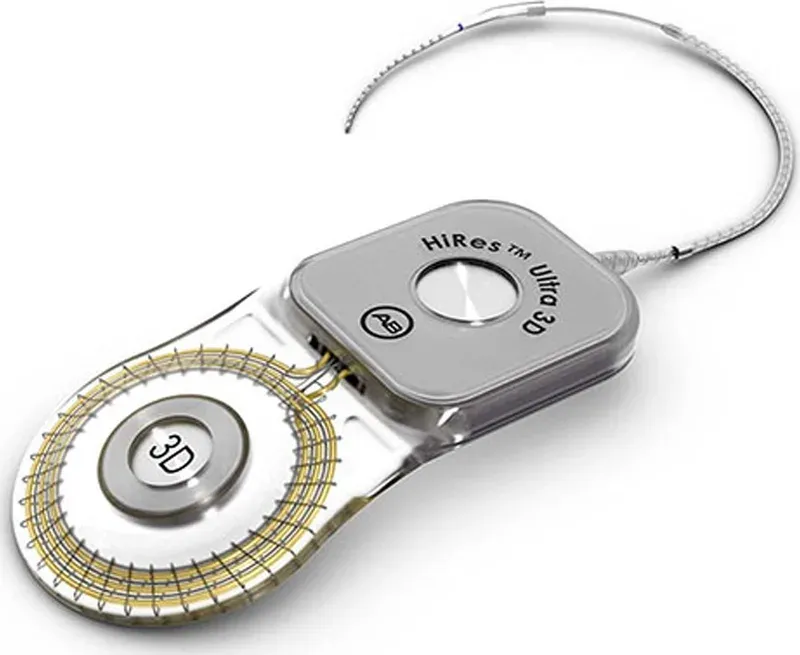 Advanced Bionics HiRes Ultra 3D Cochlea-Implantat
